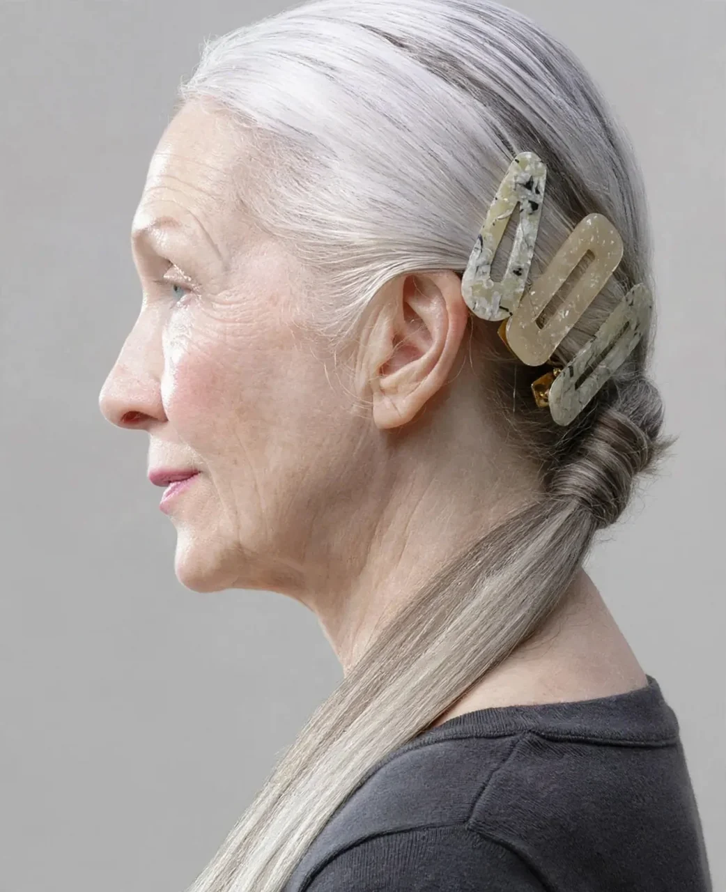 After: Neck lift · profile