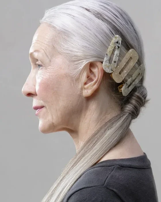 Before: Neck lift · profile